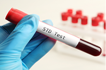 STD Testing